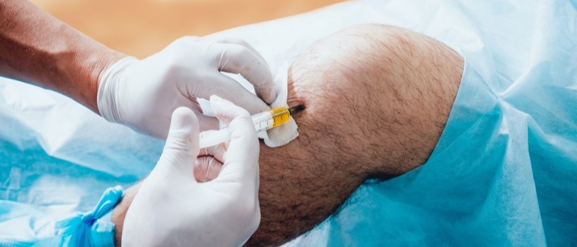 Benefits Of Prp Therapy For Joint Pain What Patients Should Know In Wellington 1